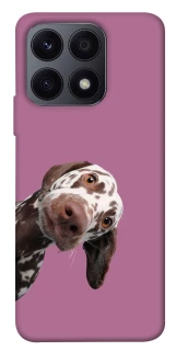 Чохол на Huawei Honor X8a А що тут фото 1 з 1