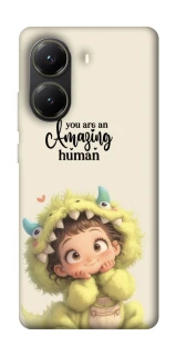 Чохол на Xiaomi Poco X6 Pro You are amazing фото 1 з 1