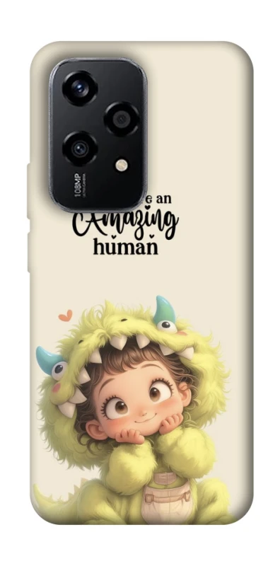 Чохол на Honor 200 Lite You are amazing фото 1 з 1