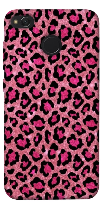 Чехол на Xiaomi Redmi 4X Leopard Skin v3 фото 1 из 1