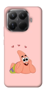 Чохол на Xiaomi 15T Pro Патрік Стар фото 1 з 1