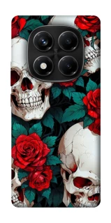 Чохол на Xiaomi Redmi Note 14 Pro 4G skull and rose фото 1 з 1