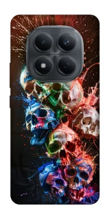Чохол на Xiaomi Redmi Note 15 Pro 4G Skulls фото 1 з 1