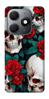 Чехол на TECNO Spark 20 skull and rose фото 1 из 1