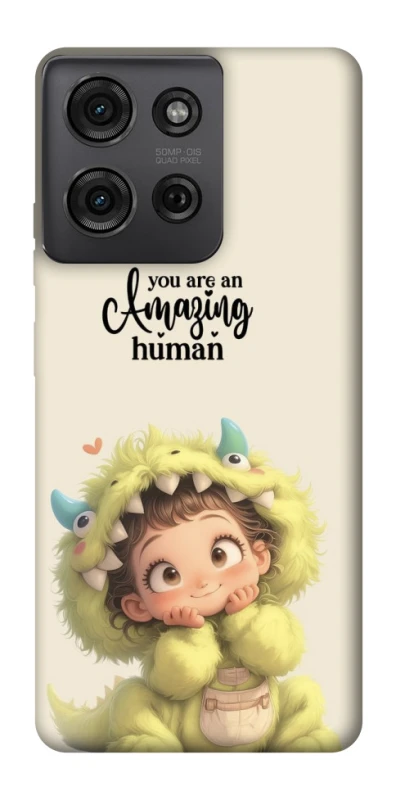 Чохол на Motorola Moto G75 You are amazing фото 1 з 1