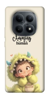 Чохол на Xiaomi Redmi Note 15 4G/5G (EU) You are amazing фото 1 з 1