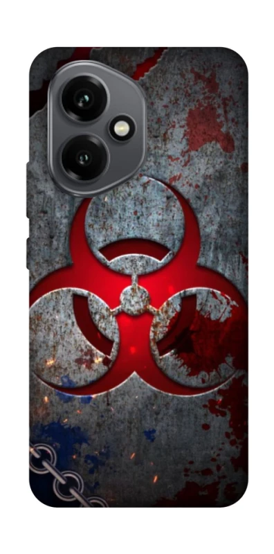 Чехол на Honor 400 Радиация v3 фото 1 из 1