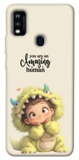 Чохол на ZTE Blade A51 You are amazing фото 1 з 1