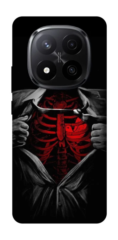 Чехол на Xiaomi Redmi Note 14 Pro+ 5G Skeleton Heart фото 1 из 1