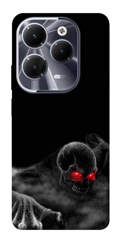Чохол на Infinix Hot 40 Skeleton v3 фото 1 з 1