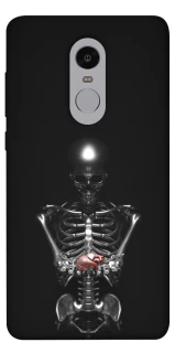 Чехол на Xiaomi Redmi Note 4X / Note 4 (Snapdragon) Скелетон фото 1 из 1