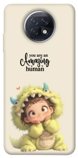 Чохол на Xiaomi Redmi Note 9 5G / Note 9T You are amazing фото 1 з 1