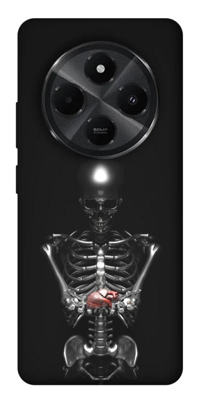 Чохол на Xiaomi Poco C75 Скелетон фото 1 з 1