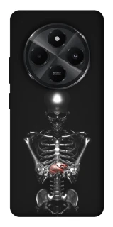 Чохол на Xiaomi Poco M7 Скелетон фото 1 з 1