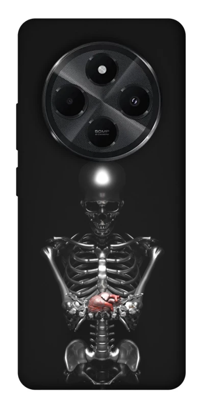Чохол на Xiaomi Redmi A4 Скелетон фото 1 з 1