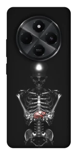 Чохол на Xiaomi Redmi A4 Скелетон фото 1 з 1