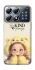 Чохол на Xiaomi POCO X8 Pro Be kind фото 1 з 1