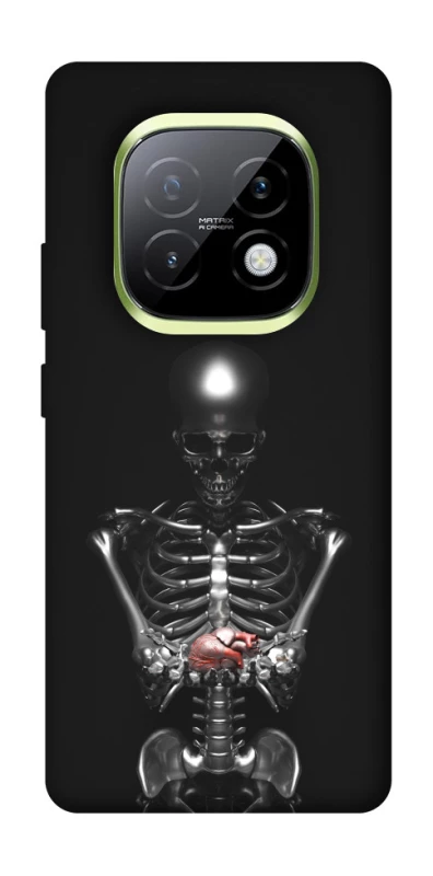 Чохол на Realme Narzo 70 Turbo Скелетон фото 1 з 1