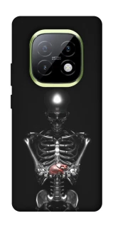 Чохол на Realme Narzo 70 Turbo Скелетон фото 1 з 1