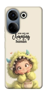 Чохол на TECNO Camon 20 Pro (CK7n) You are amazing фото 1 з 1