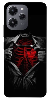 Чохол на Xiaomi Redmi 12 Skeleton Heart фото 1 з 1