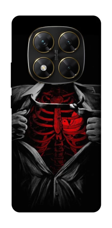 Чехол на Xiaomi Poco X7 Skeleton Heart фото 1 из 1