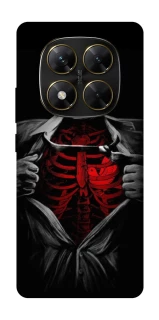 Чехол на Xiaomi Poco X7 Skeleton Heart фото 1 из 1