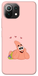 Чохол на Xiaomi Mi 11 Lite Патрік Стар фото 1 з 1