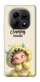 Чохол на Xiaomi Redmi Note 15 5G You are amazing фото 1 з 1