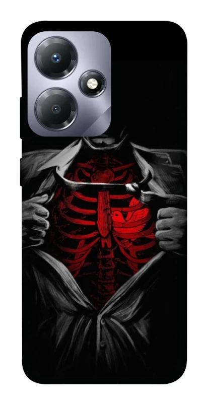 Чохол на Infinix Hot 30 Play Skeleton Heart фото 1 з 1