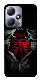 Чохол на Infinix Hot 30i Skeleton Heart фото 1 з 1