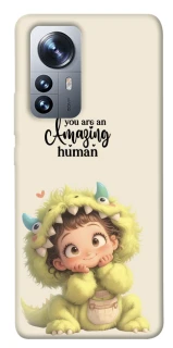 Чехол на Xiaomi 12 / 12X You are amazing фото 1 из 1