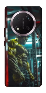 Чехол на Honor X9c Hulk v3 фото 1 из 1