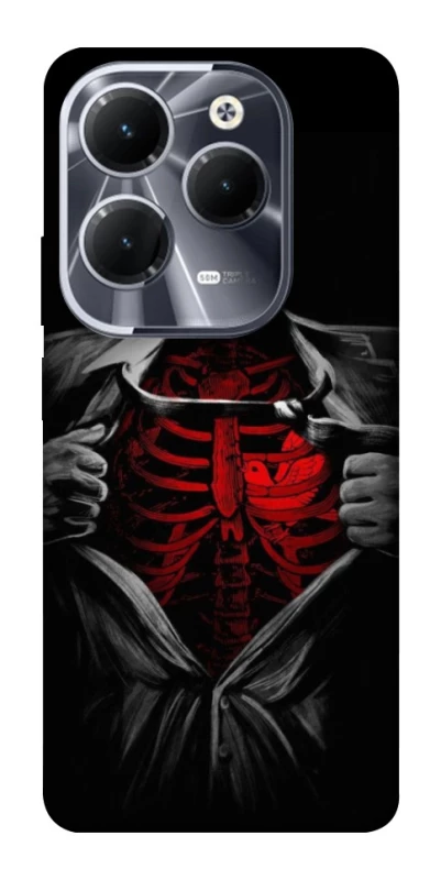 Чохол на Infinix Hot 40 Pro Skeleton Heart фото 1 з 1