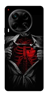 Чохол на TECNO Camon 30 (CL6) Skeleton Heart фото 1 з 1