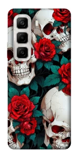 Чохол на Infinix Hot 50 4G skull and rose фото 1 з 1