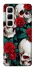 Чохол на Infinix Hot 50 4G skull and rose фото 1 з 1