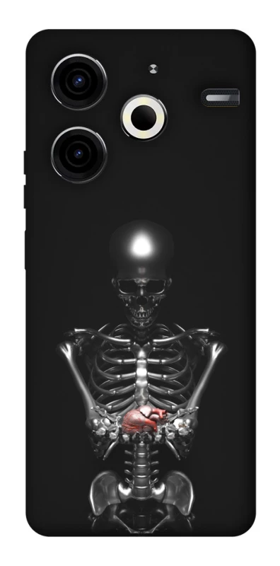 Чехол на TECNO Pova 6 Neo (LI6) Скелетон фото 1 из 1