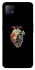 Чохол на Oppo A72 5G / A73 5G Heart with flowers фото 1 з 1