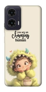 Чехол на Motorola Moto G35 You are amazing фото 1 из 1