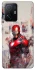 Чохол на Xiaomi 11T / 11T Pro Ironman фото 1 з 1
