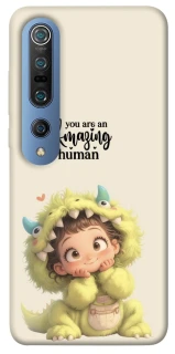 Чохол на Xiaomi Mi 10 / Mi 10 Pro You are amazing фото 1 з 1