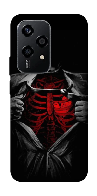 Чехол на Honor 200 Lite Skeleton Heart фото 1 из 1