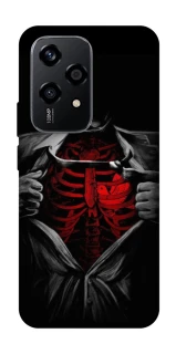 Чехол на Honor 200 Lite Skeleton Heart фото 1 из 1