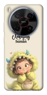 Чохол на ZTE Blade V70 Max You are amazing фото 1 з 1