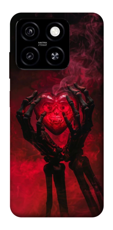 Чохол на ZTE Blade A55 4G Heart in the hands of a skeleton фото 1 з 1
