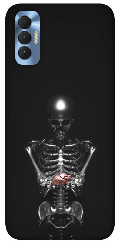 Чехол на TECNO Spark 8P Скелетон фото 1 из 1