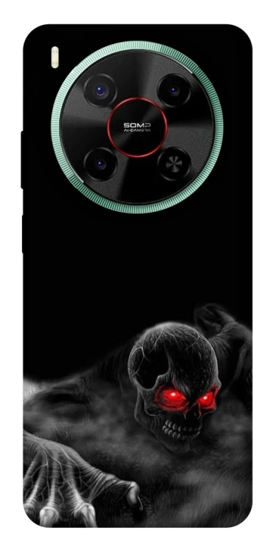 Чохол на ZTE Nubia V70 Max Skeleton v3 фото 1 з 1