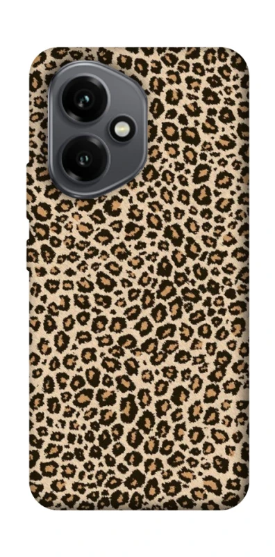 Чохол на Honor 400 Leopard Skin v2 фото 1 з 1