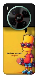 Чехол на ZTE Nubia V70 Max Bart фото 1 из 1